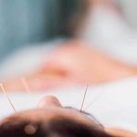Treat Your Illness In These Acupuncture NJ Clinics